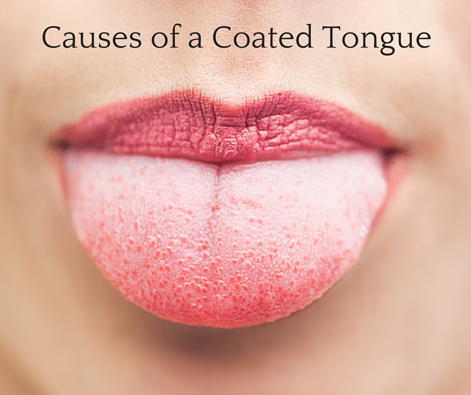 Learn the causes of a coated tongue - Dr Chauvin
