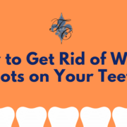 How to Get Rid of White Spots on Your Teeth - dr chauvin lafayette la