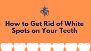 How to Get Rid of White Spots on Your Teeth - dr chauvin lafayette la