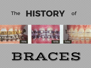 history of braces