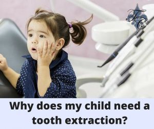 Why does my child need a tooth extraction- dr chauvin lafayette la dentist
