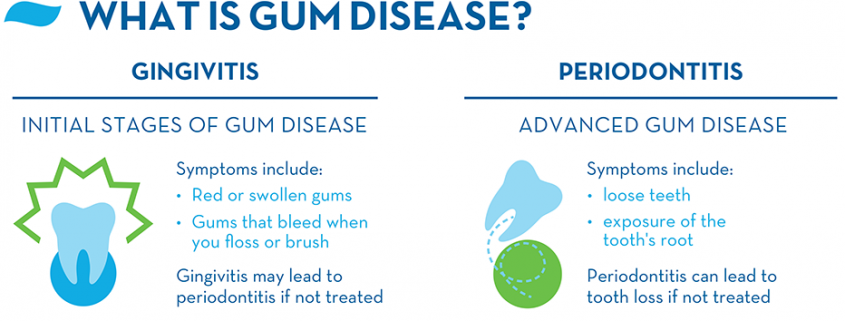 what-is-gingivitis-and-periodontitis