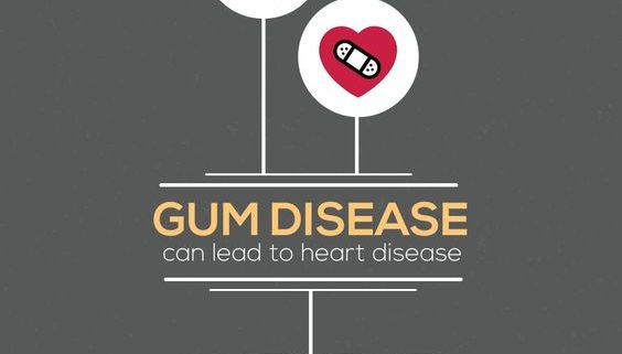 gum health chauvin lafayette