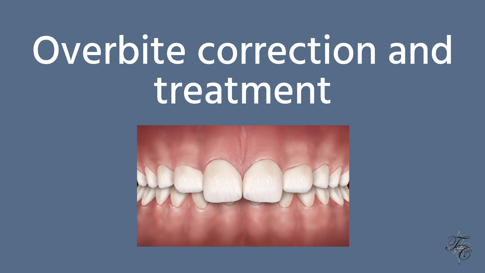 Overbite correction and treatment